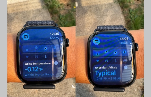 Thermometer Watch – Khi đồng hồ không chỉ đo thời gian